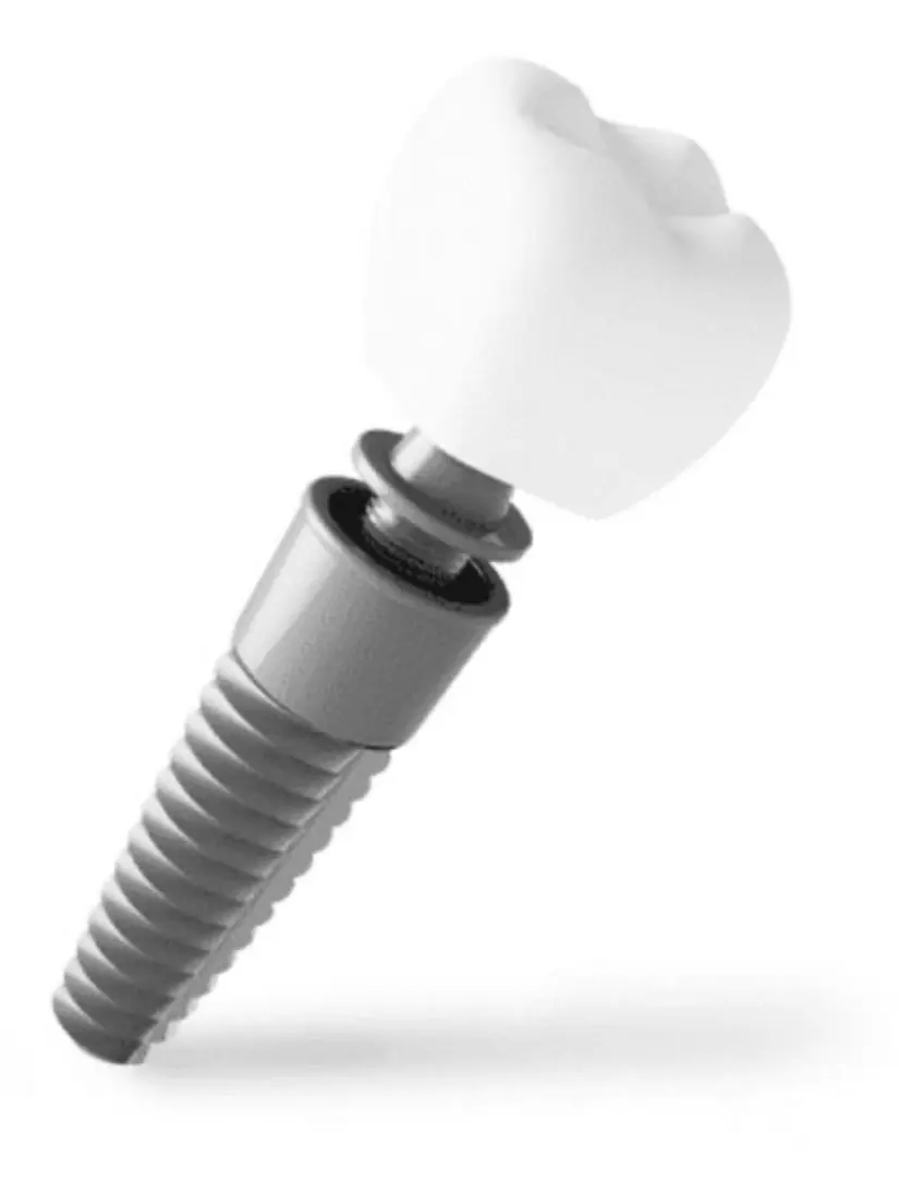Studio image of a dental implant crown on its post