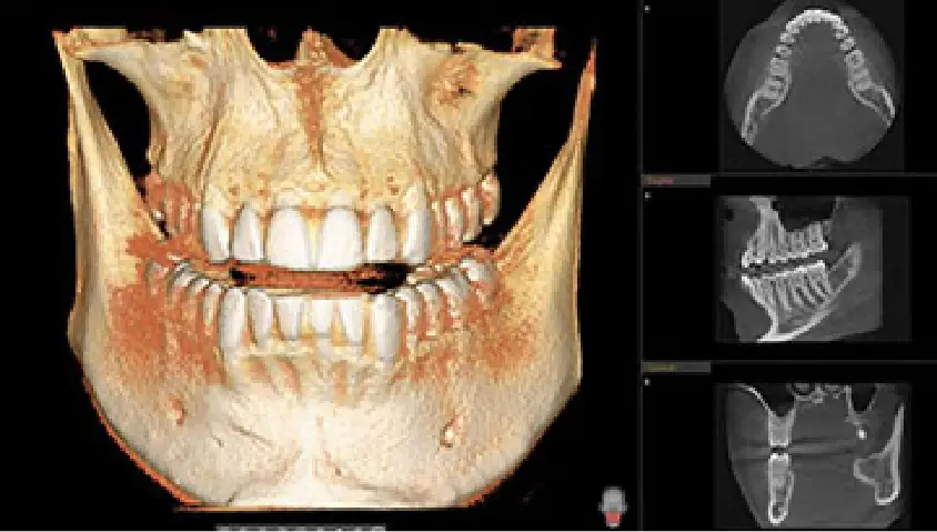 3D CBCT scan interface used for comprehensive treatment planning